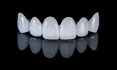 Row of white porcelain veneers on a black background